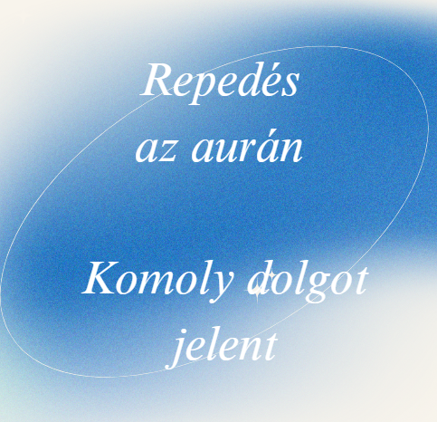 Repedés az aurán - Komoly dolgot jelent