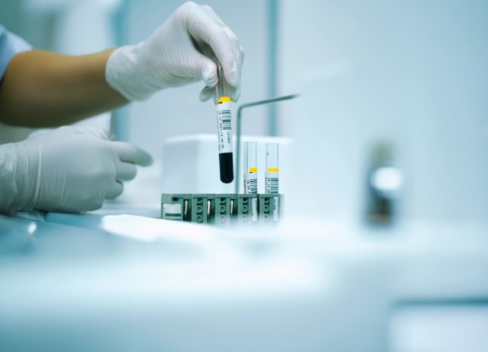 Téli immunerősítés: Laborvizsgálat segít a betegségek ellen?